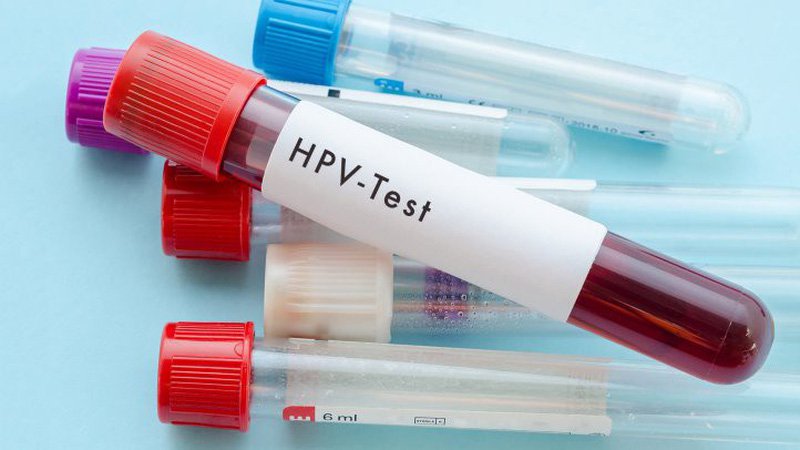 Xét nghiệm HPV chẩn đoán bệnh gì? và hướng dẫn đọc kết quả